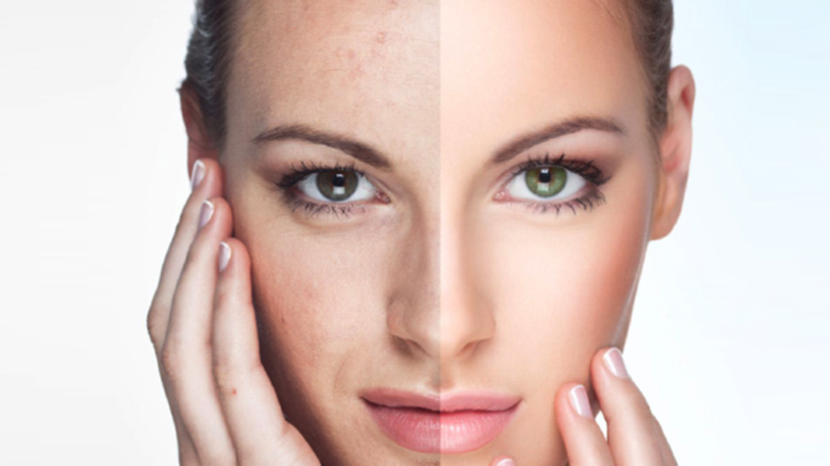 How Much Does Full Face Rejuvenation Cost